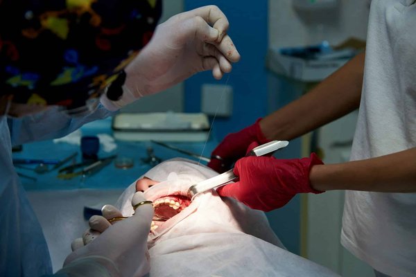 Le Centre dentaire Caroline Prud'homme effectue-t-il des chirurgies dentaires ?